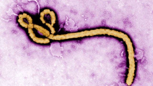 ebola virus