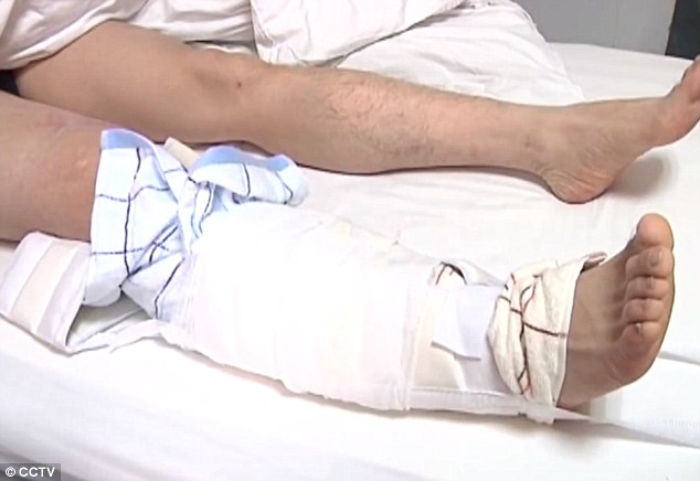 Injured: Most of the injuries Feng sustained are to the right side of his body, including his right knee cap
