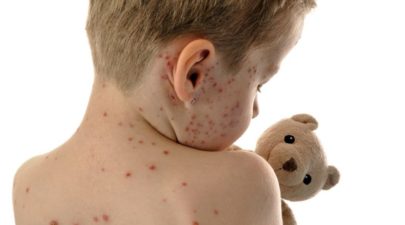 5a7320b71dc524fd458b45fe 1