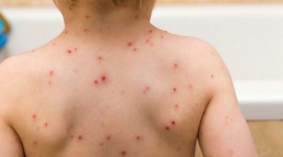 5ac782f31dc524e84c8b478f