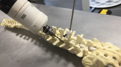 ρομπότ εγχείρηση σπονδυλική στήλη