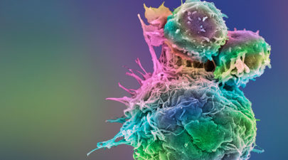 T cell κύτταρο Τ ανοσοθεραπεία