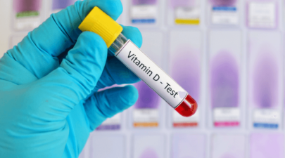 vitamin d deficiency test prices in india