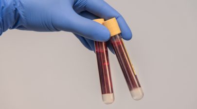 blood sample 6200016 1920 0