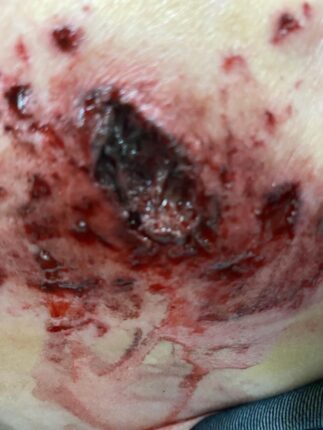 thumbnail trafmatismos diadilotrias 28 2 24