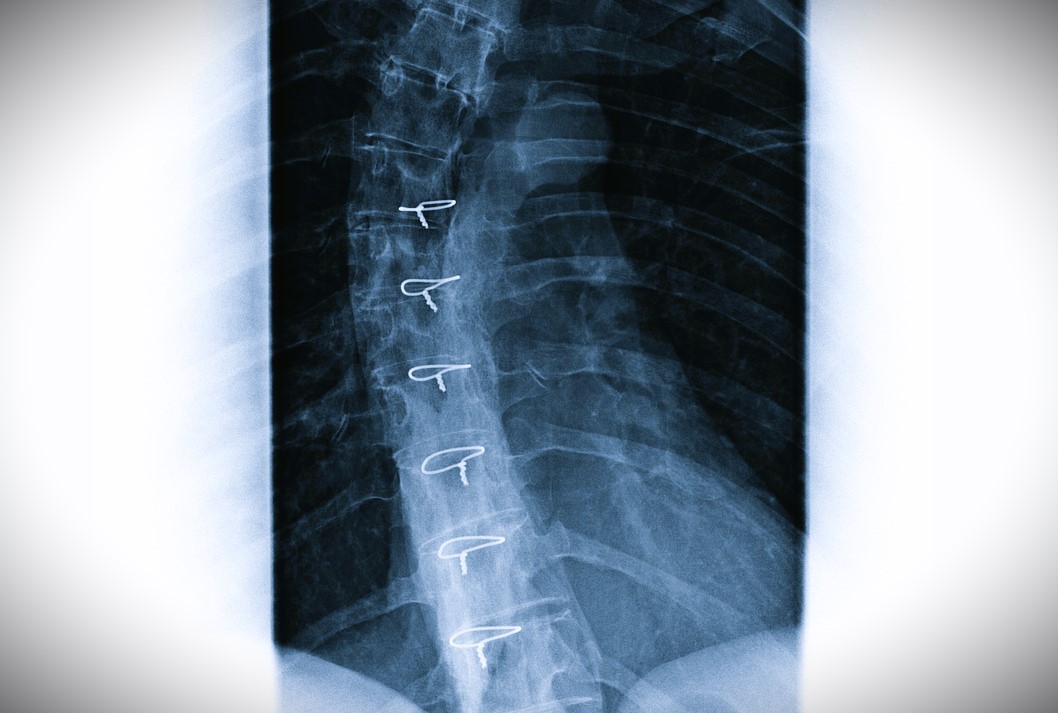 Χανιά κουνέλι