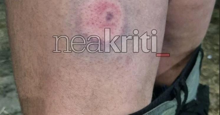 Φωτογραφία για: Αγρότες: Οι αστυνομικοί τους πυροβόλησαν με πλαστικές σφαίρες στην Κρήτη - Φωτογραφίες ντοκουμέντο 4 agrotes_plastikes_sfaires