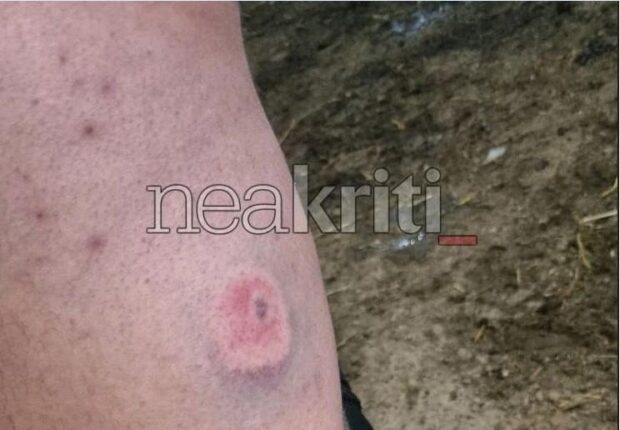 Φωτογραφία για: Αγρότες: Οι αστυνομικοί τους πυροβόλησαν με πλαστικές σφαίρες στην Κρήτη - Φωτογραφίες ντοκουμέντο 2 agrotes_plastikes_sfaires_3