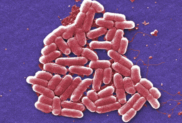 Escherichia coli 1