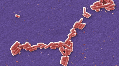 Escherichia coli