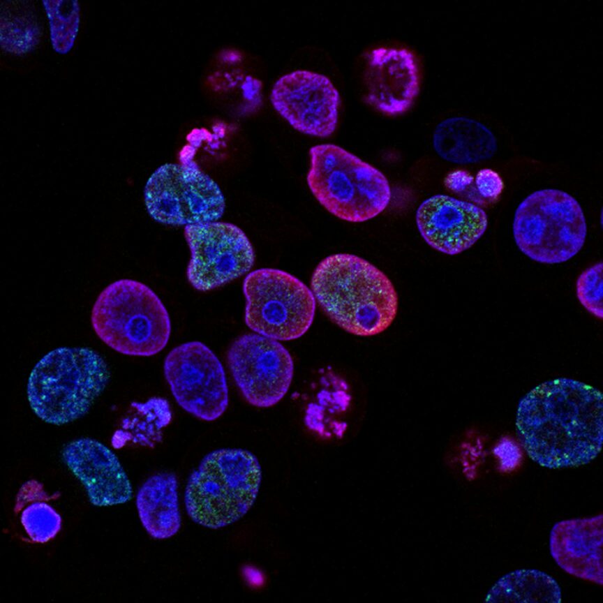 national cancer institute L7en7Lb Ovc unsplash