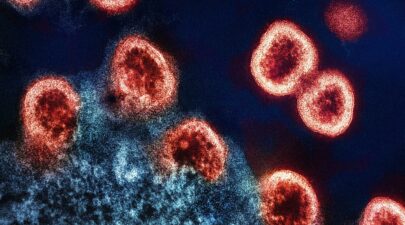 national institute of allergy and infectious diseases cxUtwHxNGmo unsplash