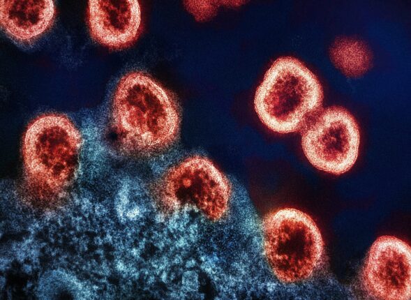 national institute of allergy and infectious diseases cxUtwHxNGmo unsplash